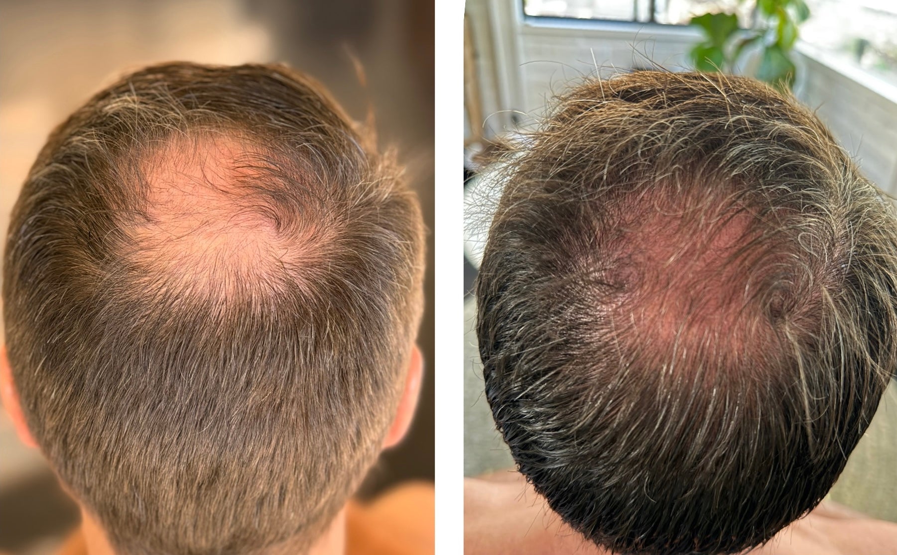 Hair Support Serum
